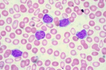 Alercell planeja introduzir novo teste de diagnóstico de leucemia no próximo ano