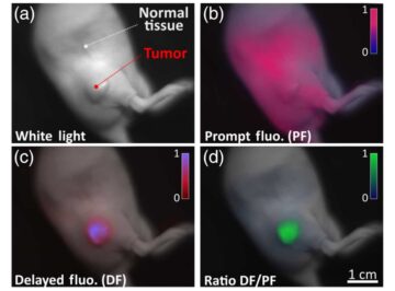 Delayed fluorescence imaging helps identify cancerous tissue during surgery