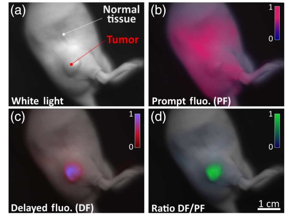 Die verzögerte Fluoreszenzbildgebung hilft bei der Identifizierung von Krebsgewebe während der Operation