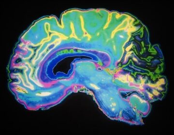Το έργο που καθοδηγείται από το UQ χρησιμοποιεί τον «εγκέφαλο σε ένα πιάτο» για να μελετήσει τις επιπτώσεις του ιού Ζίκα