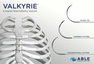 Able Medical Devices presenta suturas de alambre en bucle