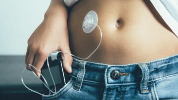 The quest for a truly artificial pancreas