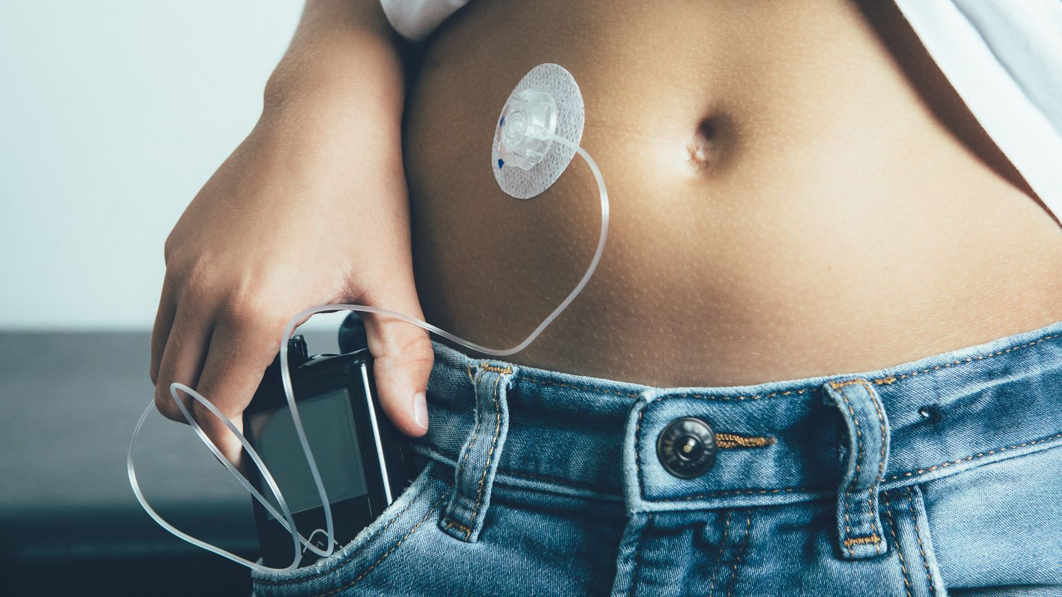 The quest for a truly artificial pancreas