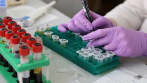 FDA przyznaje uprawnienia EUA do testu Xpert Mpox firmy Cepheid