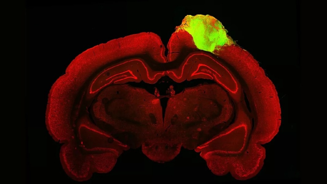 Mini-cerebros humanos injertados en ratas heridas restauraron su vista