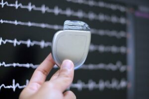 Novidade no mercado de cardioversores desfibriladores implantáveis