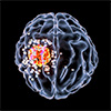 使用纳米粒子让药物穿过血脑屏障