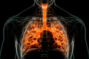 Novi nanodelci lahko izvajajo urejanje genov v pljučih