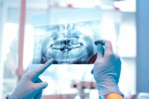 DEXIS pridobi dovoljenje FDA za programsko opremo za slikanje zob, ki jo poganja AI