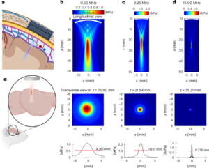 Ektopična ekspresija mehansko občutljivega kanala daje prostorsko-časovno ločljivost ultrazvočnim stimulacijam nevronov za obnovitev vida