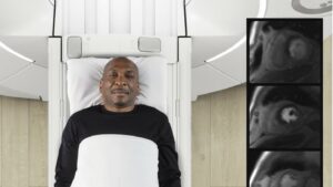 GE HealthCare presenta il nuovo agente MRI Pixxoscan