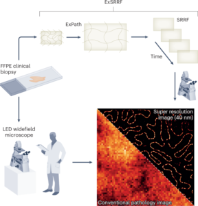 Imaging pathology goes nanoscale with a low-cost strategy