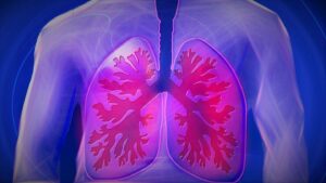 Mercy BioAnalytics збирає 41 мільйон доларів на скринінговий тест на рак легенів