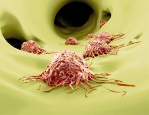 Sphere Fluidics inizia a lavorare con i partner sul programma 3DSecret per studiare i meccanismi delle metastasi nel cancro