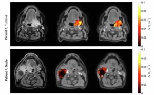 Towards combined hypoxia imaging and adaptive radiotherapy