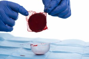 Tehnologija za celjenje ran na osnovi krvi zajema 26 milijonov dolarjev naložbe