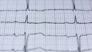 Розробник дистанційного моніторингу серця PaceMate співпрацює з AliveCor