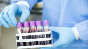 Study shows ClearNote’s test’s performance in pancreatic cancer detection