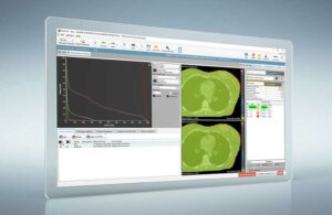 QA pasien otomatis menggunakan perangkat lunak RadCalc untuk perawatan tomoterapi heliks di University Hospital Cologne – Physics World