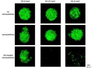 Nanopartikel bermuatan Gd ditambah sinar-X monokromatik dapat menghancurkan tumor – Dunia Fisika