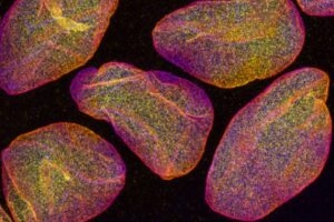 Nanokokoinen voimaanturi parantaa erittäin tarkkaa mikroskopiaa
