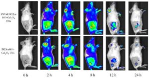 Nanoplates tag neuroblastoma to guide tumour surgery – Physics World