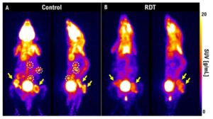 Radiodynamic therapy: harnessing light to improve cancer treatments – Physics World