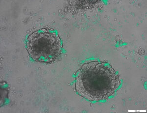 Forskare konstruerar bakterier som kan upptäcka tumör-DNA