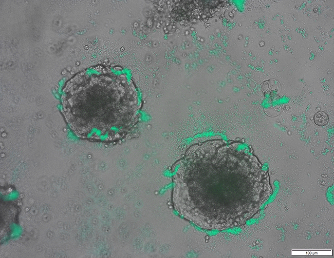 연구자들은 종양 DNA를 탐지할 수 있는 박테리아를 조작합니다.