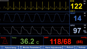 What Can We Do With These Patient Monitor Videos?
