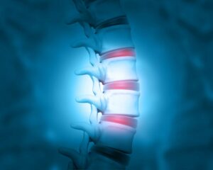 FDA approves IDE for HYDRAFIL system in degenerative disc disease study