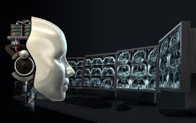 הוצאה הנחיה עבור MRI מושרף בינה מלאכותית
