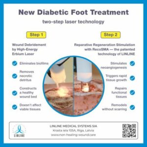 획기적인 연구를 통해 당뇨병성 발에 대한 새로운 RecoSMA 레이저 치료의 효과가 밝혀졌습니다