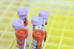 Nanostics führt in Alberta, Kanada, einen Bluttest für Prostatakrebs ein