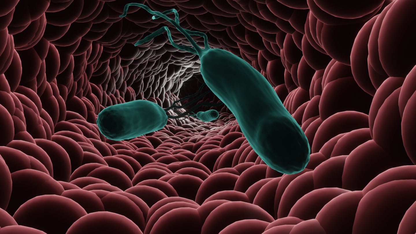 Biomerica swings 501(k) clearance for H. pylori bacteria diagnostic test