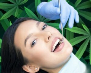 هل يؤخذ CBD عن طريق الفم لمحاربة تسوس الأسنان وأمراض اللثة؟ - تظهر الدراسات الجديدة أن اتفاقية التنوع البيولوجي تساعد في صحة الأسنان