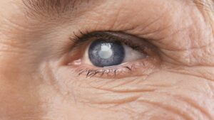 Glaukos eye implant swings FDA approval