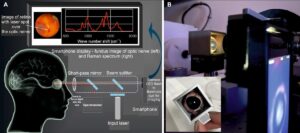 Η φορητή συσκευή χρησιμοποιεί φασματοσκοπία αμφιβληστροειδούς ασφαλούς για τα μάτια για τη διάγνωση εγκεφαλικής βλάβης - Physics World