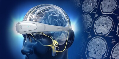 Relivion® Brain Neuromodulation Therapy
