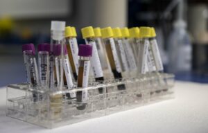 Savara lança exame de sangue aPAP ClearPath para doenças pulmonares raras