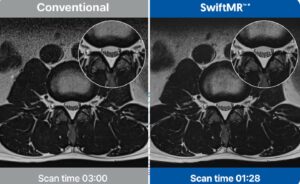 Az AIRS Medical SwiftMR AI-alapú MRI-megoldása biztosítja az EU-tanúsítványt