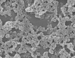 Aminosyre-nanopartikler viser løfte om kræftbehandling