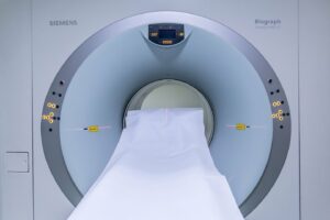 FDA одобрило расширенную маркировку нейростимулятора Abbott для МРТ