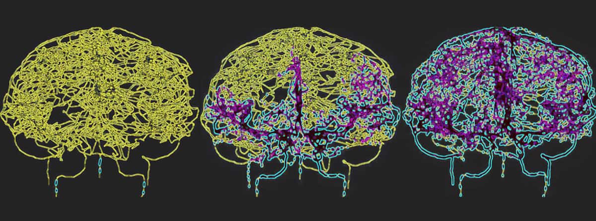 Modelling blood flow in the brain