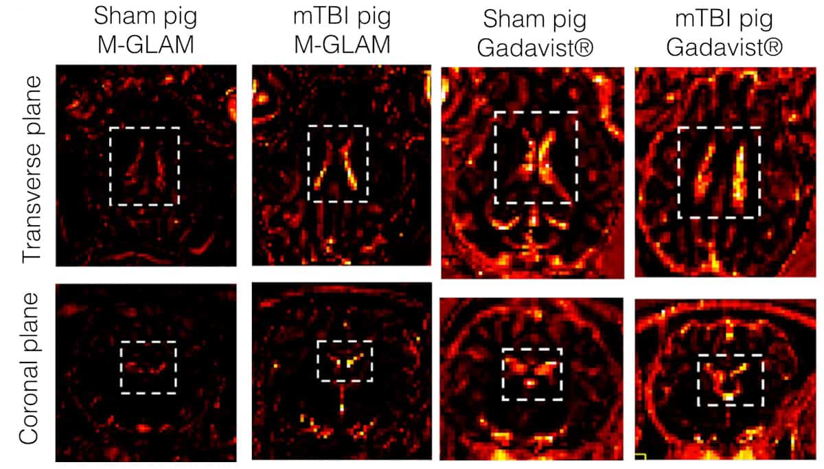 MRI maps of control pigs and pigs with mild TBI