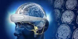 Neurolief's Relivion® säkrar regulatoriskt godkännande i Japan, banbrytande för behandling av migrän hemma | BioSpace